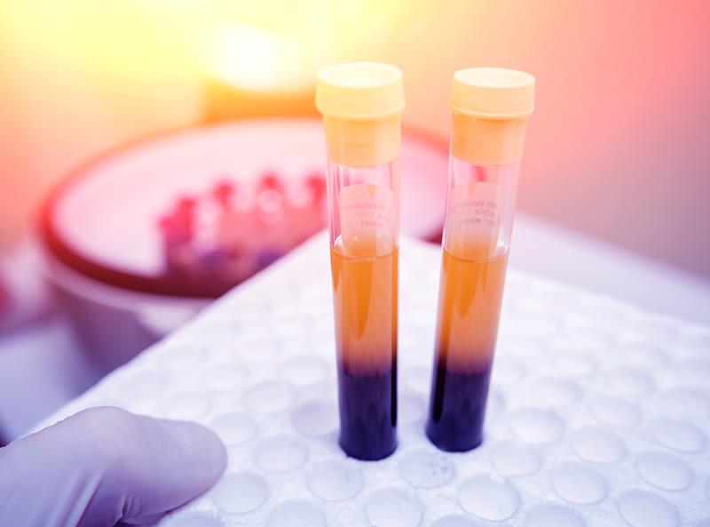 PRP & Regenerative Medicine